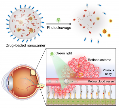 The research team developed a green light-responsive nanocarrier based on the self-assembly of photocleavable three-legged molecules. After intravenous injection of drug-loaded nanocarriers, the light-triggered drug release in retinoblastoma exhibited significant anticancer efficacy and minimal side effects.